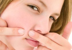 Como curar a acne de uma forma natural Como curar a acne de uma forma natural