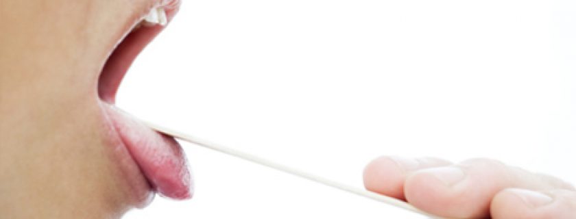 Dicas para prevenir a amigdalite