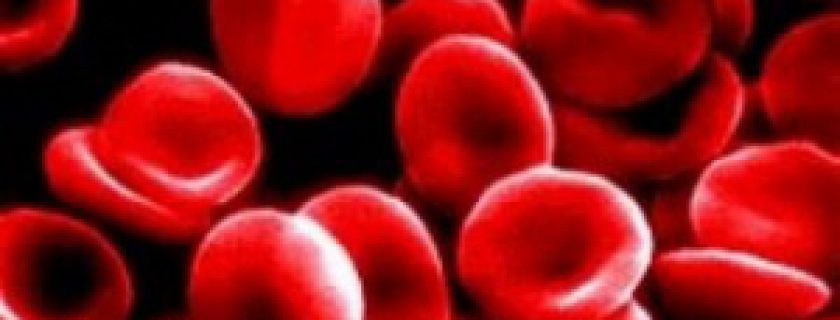Anemia ferropriva: falta de ferro