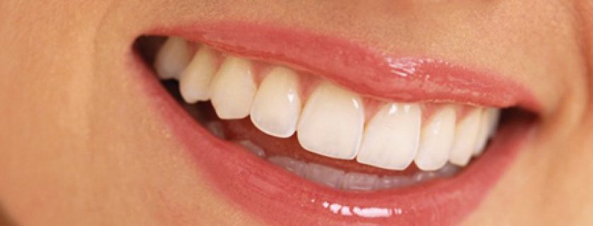 Aprenda como clarear os seus dentes