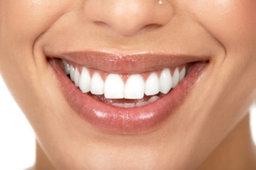 Dicas caseiras para branquear os dentes Dicas caseiras para branquear os dentes