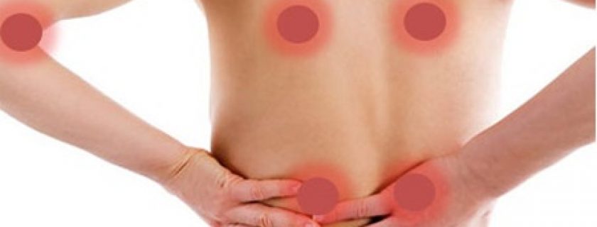 Dia Mundial da Fibromialgia: Exercício físico um aliado contra esta doença
