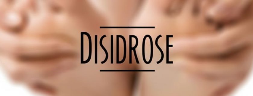 Disidrose: causas, sintomas e tratamentos