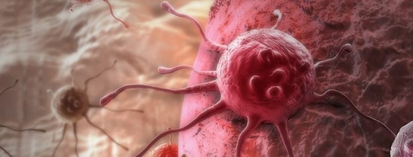 Estudo revela maneira simples de reduzir o risco de 13 tipos de câncer