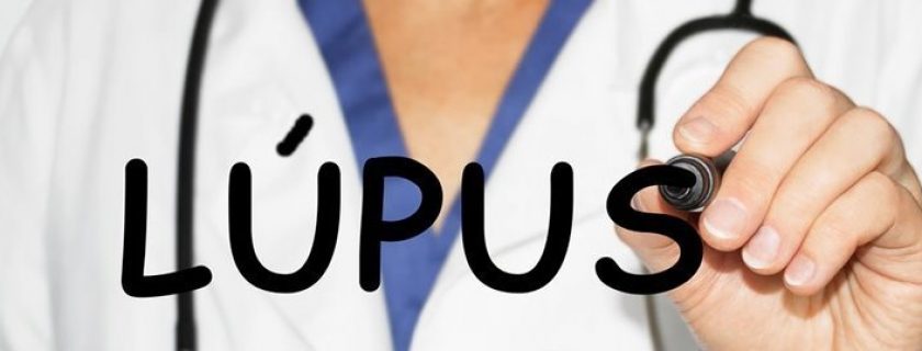 7 maneiras simples de tratar o lúpus de forma natural