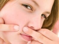Como curar a acne de uma forma natural