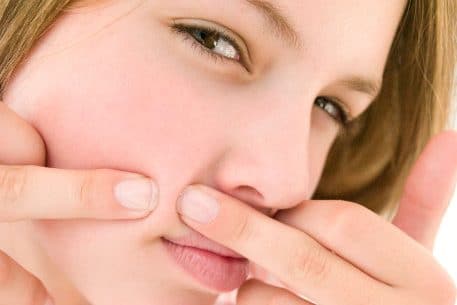 Como curar a acne de uma forma natural