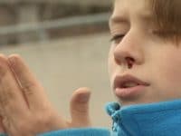 O que fazer no caso de uma hemorragia nasal