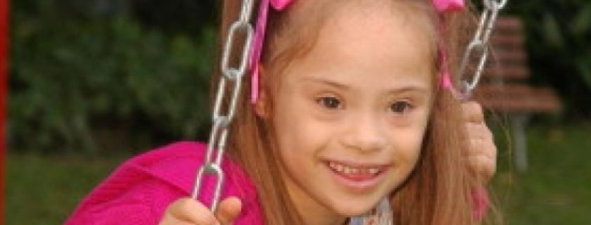 Quando o bebê nasce com síndrome de down