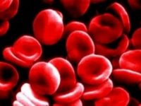 Anemia ferropriva: falta de ferro