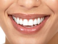 Dicas caseiras para branquear os dentes