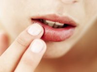Como fazer um protetor labial em casa