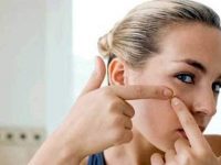 10 dicas para remover cravos