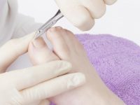 Remédios caseiros para tratar as unhas encravadas