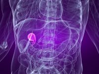 Remédios caseiros para o cálculo na vesícula