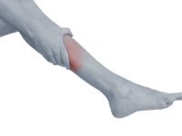 Remédios caseiros para combater a inflamação