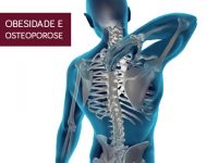 A obesidade aumenta o risco de osteoporose