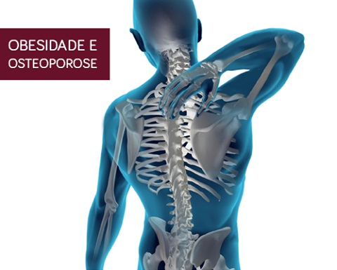 A obesidade aumenta o risco de osteoporose A obesidade aumenta o risco de osteoporose