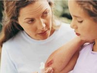 Remédios caseiros para feridas leves