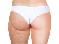 Auto-massagens para reduzir a celulite