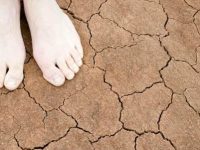 Tratamentos naturais para pés secos