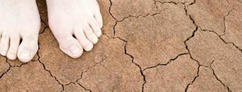 Tratamentos naturais para pés secos
