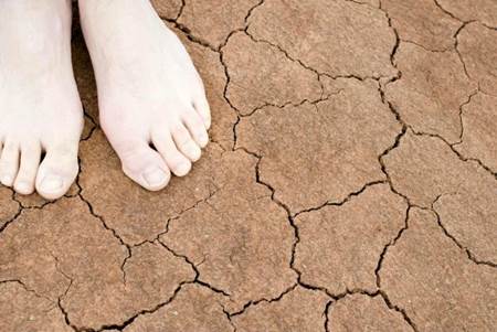 Tratamentos naturais para pés secos