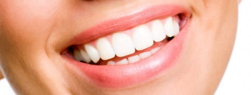 Como branquear os dentes de forma caseira