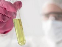 O que diz a cor de sua urina a respeito de sua saúde