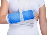 Fumar e beber álcool atrasa na recuperação da fratura