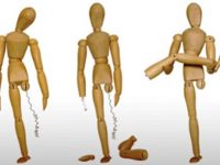 Cuidados prévios em uma amputação