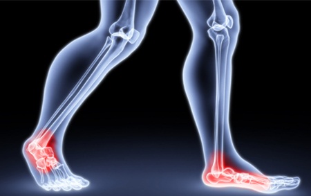 Sensibilidade nos pés de pacientes diabéticos
