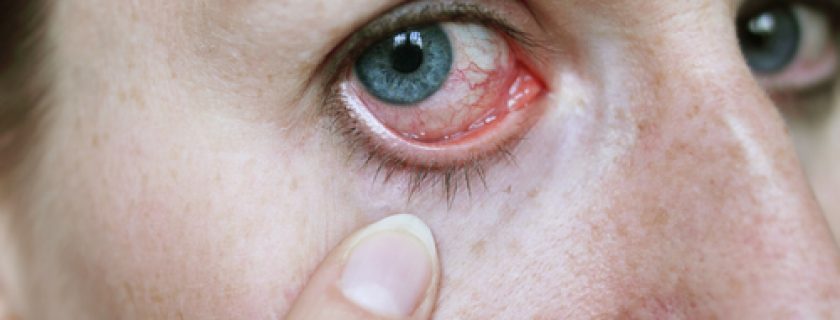 Seus olhos podem refletir seu estado de saúde