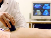 Ultrassonografia e o diagnóstico na fisioterapia