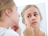 Acabe com a acne desde o início e evite cicatrizes