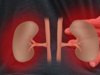 Cálculo renal: tipos, sintomas e dieta para prevenir