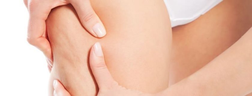 7 frutas mais indicadas para prevenir ou tratar a celulite