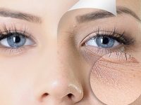 11 alimentos que reduzem as rugas e vão te deixar mais jovem