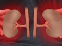 10 hábitos comuns que podem causar sérios danos a seus rins