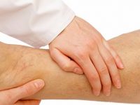 7 sinais de má circulação sanguínea e como tratar o problema