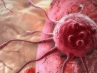 Estudo revela maneira simples de reduzir o risco de 13 tipos de câncer