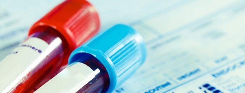 4 remédios caseiros para baixar a creatinina no sangue