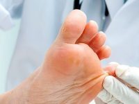 Fungo na unha: 6 dicas essenciais para prevenir esse problema