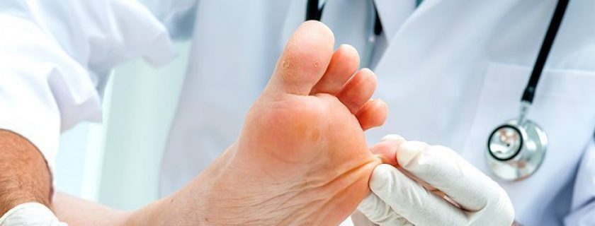 Fungo na unha: 6 dicas essenciais para prevenir esse problema