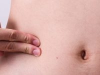 7 principais sintomas de apendicite que você precisa conhecer