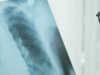 Conheça os principais sintomas e tratamentos da tuberculose