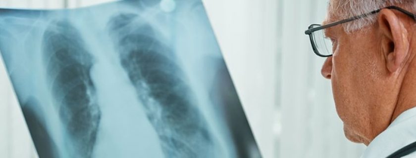 Conheça os principais sintomas e tratamentos da tuberculose