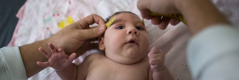O que é microcefalia e quais suas consequências ao bebê