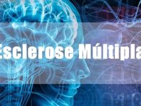 O que é esclerose múltipla e como tratar os sintomas dessa doença