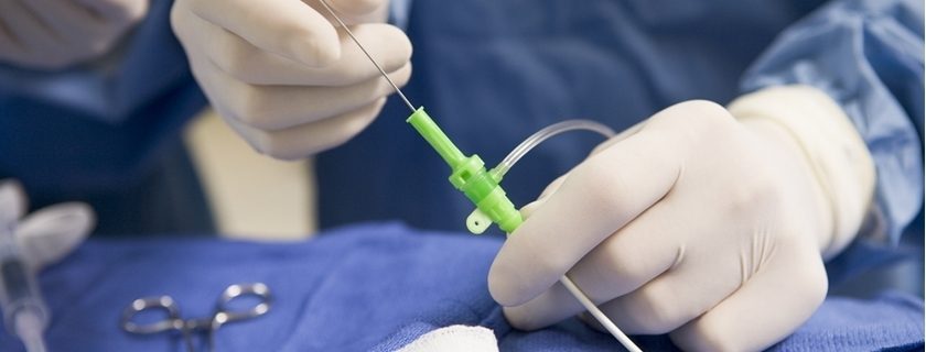 O que é cateterismo cardíaco e como é feito esse procedimento